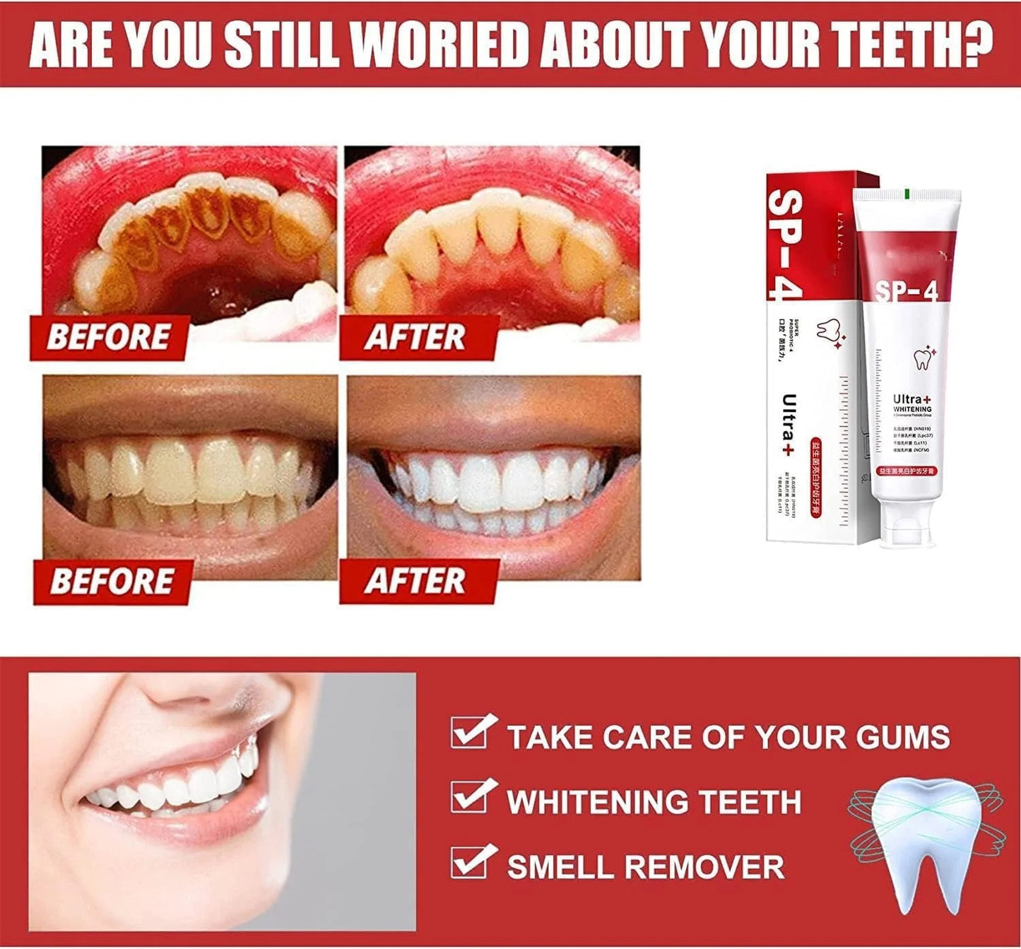 🔥Super Probiotic-6 Toothpaste with 6 Probiotics
